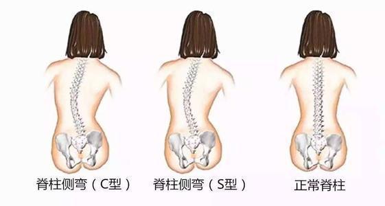 坚持这样练1周不仅小腹紧米乐·M6下载致四肢变得纤细有型气质也秒涨(图4)