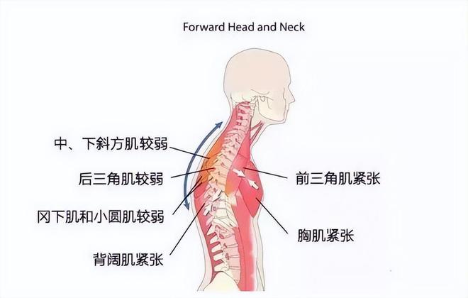 健身米乐官方平台不练背只会越练越废！6个动作高效练背(图4)